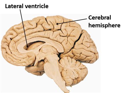 left and right lateral ventricles.